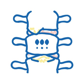 ankylosing spondylitis icon doodle illustration vector
