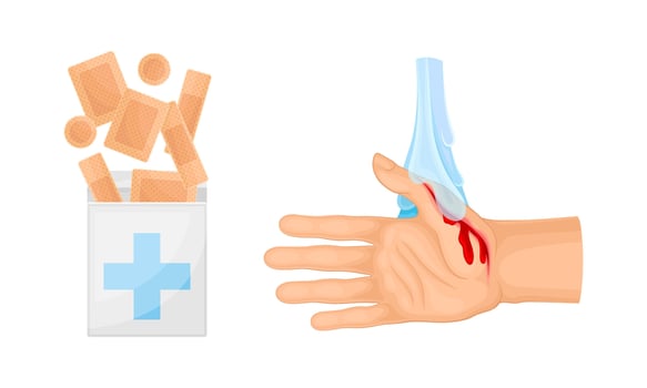 Skin burn injury treatment. First aid for thermal wound. Hand under cool water illustration vector