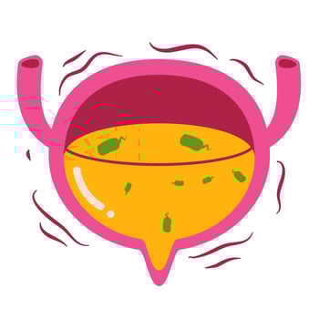 Bladder disease illustration. Urinary tract infection vector