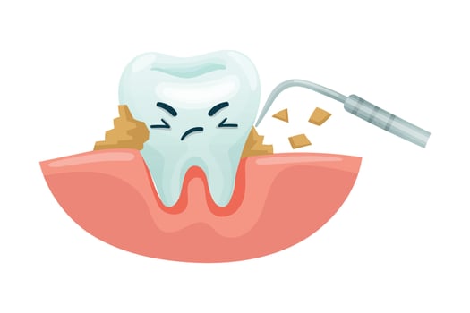 Cleaning teeth with dentist tool. Oral care, mouth hygiene, teeth restoration concept cartoon illustration vector
