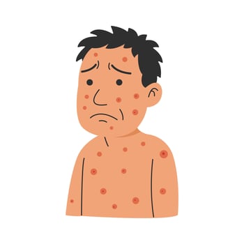 syphilis symptoms. syphilis man disease concept vector