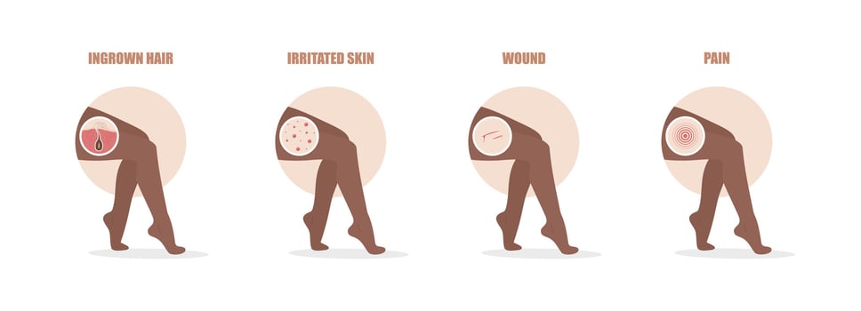 Hair removal problems. Ingrowing hair, irritated skin, wound and pain after epilation. African female legs. Skin care. illustration in flat cartoon style vector