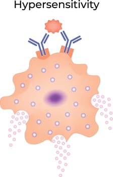 Hypersensitivity Reaction Illustration vector