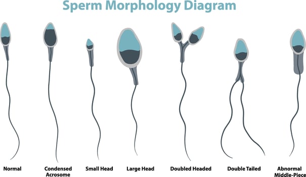 illustration of sperm morphology diagram vector
