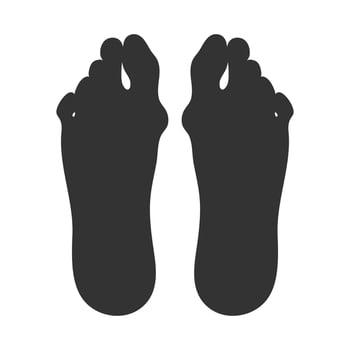 Silhouette of feet sole with a Hallux valgus deformation. Bunion of a big toe vector