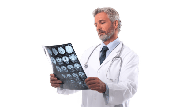 Doctor reviewing brain mri scan on transparent background png