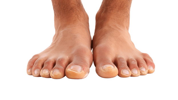 Man showing discolored toenails on transparent background png