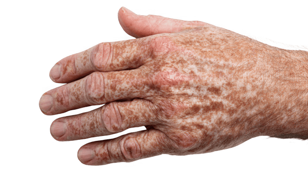 Elderly hand showing age spots on transparent background png