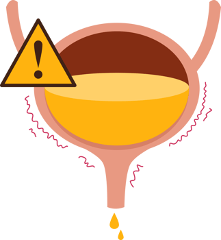 Bladder disease illustration. Involuntary urination png