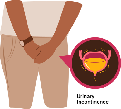 Man experience Urinary incontinence illustration png