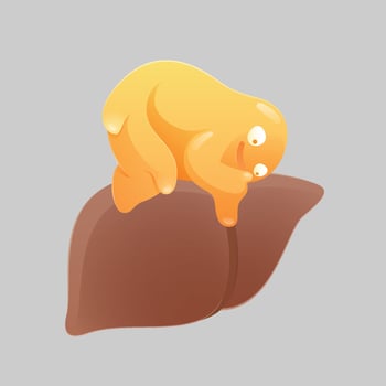 Cartoon concept for fatty liver disease or hepatic steatosis disease vector