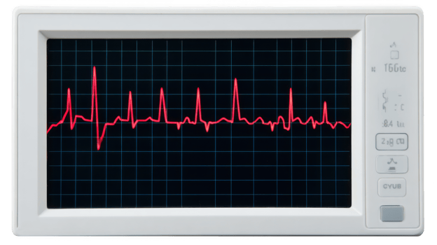 Electrocardiogram monitor displaying heartbeat on transparent background png