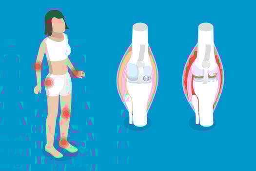 Illustration of joint pain and anatomy vector