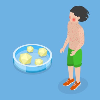 3D Isometric Flat Conceptual Illustration of Fifth Disease, Kid Disorder vector