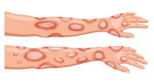 Understanding Skin Rash Conditions Symptoms Causes Diagnosis and Treatment Options A Complete Guide vector