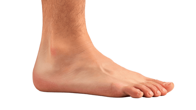 Swollen foot showing signs of inflammation on transparent background png