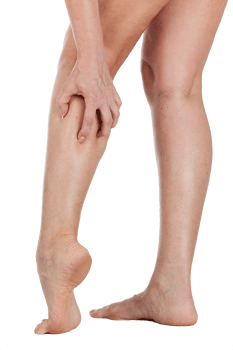 Female legs with vascular stars on the skin, isolated. png