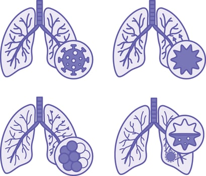 Colored Icons of Lung Disease, Bronchitis, COPD, and Pneumonia. Icons of Various Lung Diseases. Healthcare and Medicine vector