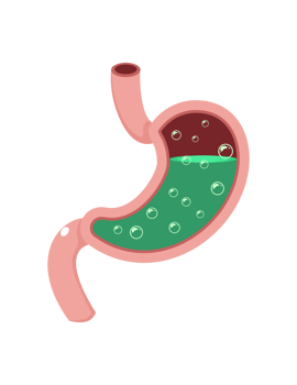 Gastroesophageal reflux disease. GERD stomach acid isolated on transparent background. Health care and medicine illustration flat style png