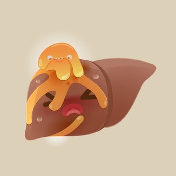 The cartoon concept for fatty liver disease disease. vector
