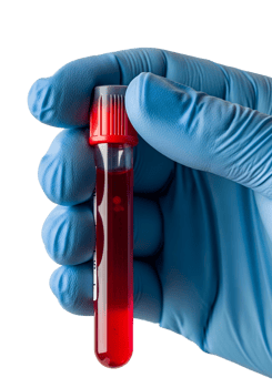 Gloved hand holding blood-filled test tube isolated on transparent background, medical lab test or diagnosis png