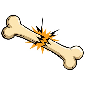Broken bone cartoon drawing in line style. illustration isolated on white background perfect for injury, trauma, or medical theme designs vector