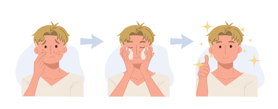 skin care concept. acne treatment before and after, facial cleansing foam, men's skin care. vector