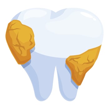 Tartar and plaque building up on a tooth, causing dental problems vector