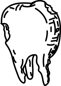Implant Tooth Cartoon, Dental Prosthesis Icon png