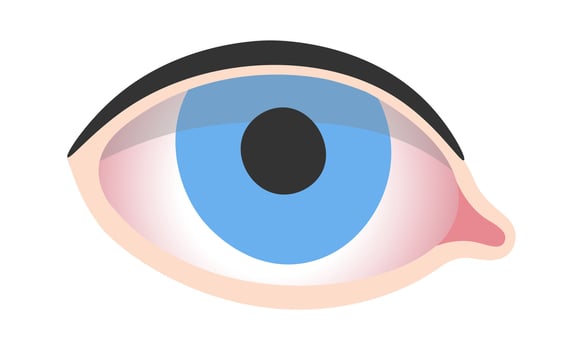 Dry Eyes Disease vector
