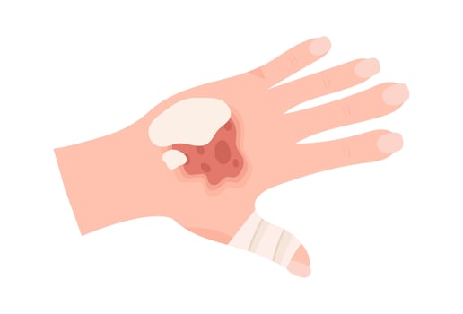 First Aid Bandaged Hand Illustration vector