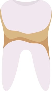 Plaque Tooth Problem vector
