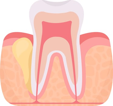 Flux Tooth Problem Illustration vector