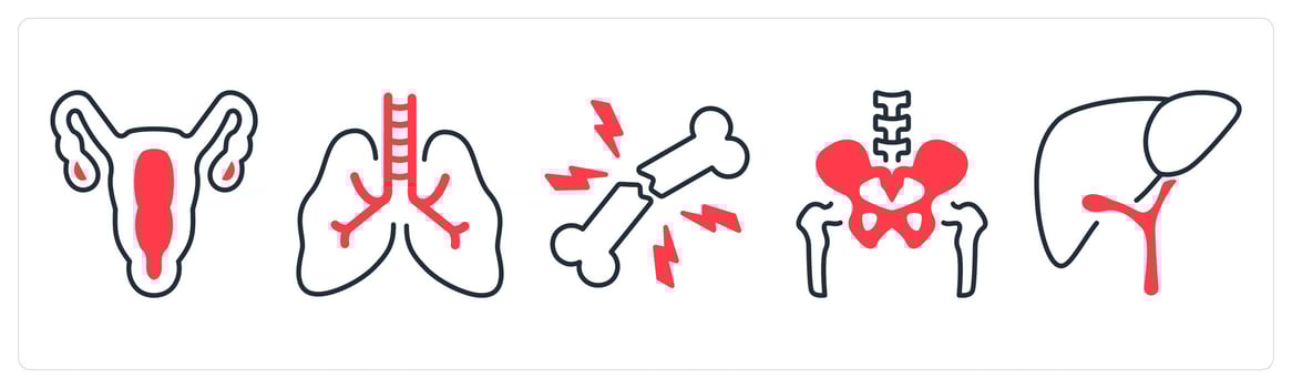 A set of 5 mix icons as gynecology, pulmonology, broken bone in red color vector