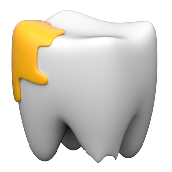 Dental decay 3d illustration in modern design stylee png