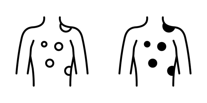 Skin cancer Icon set. Symbol isolated white background. illustration. color editable. vector