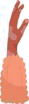 Human Vitiligo Hand Flat Illustration vector