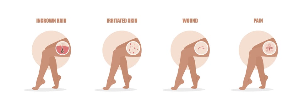 Hair removal problems. Ingrowing hair, irritated skin, wound and pain after epilation. Female legs. Skin care. illustration in flat cartoon style vector