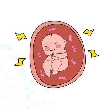 syphilis symptoms. baby syphilis disease concept vector