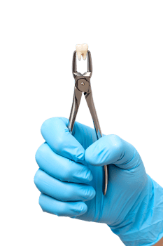 Dental forceps holding extracted tooth, oral surgery procedure isolated on transparent background png