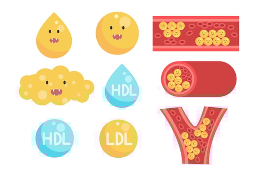Cholesterol Buildup in Blood Vessel vector